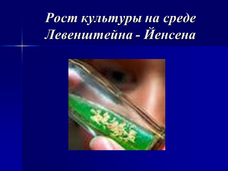 Рост культуры на среде Левенштейна - Йенсена